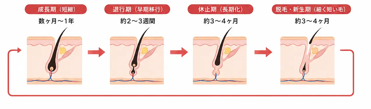 AGAの毛周期の図解